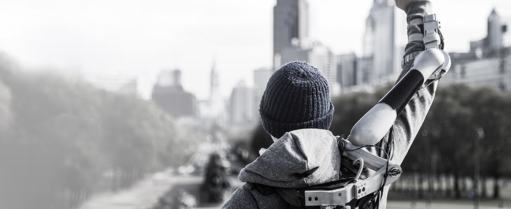 James Dyson Award - Titanové rameno